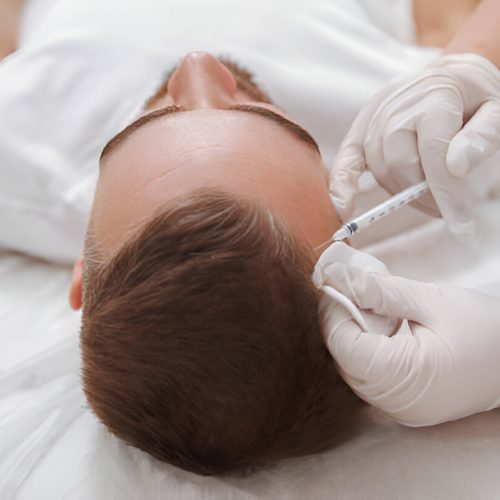 PRP Hair Treatment at Batth Medicals